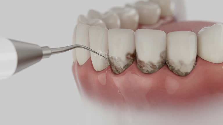 Trusted Emergency Dentist service in Hebron, IN - Dentist Open Now